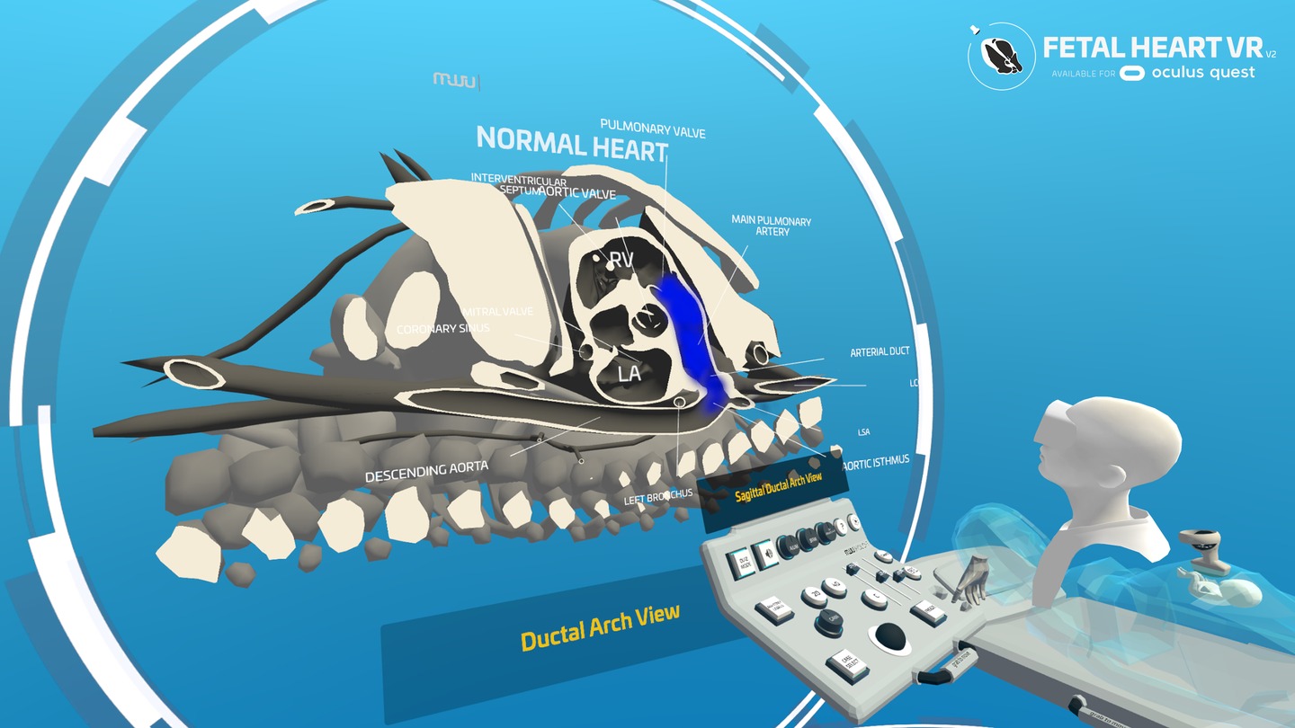 Oculus Quest game "Fetal Heart VR" Fetal Heart VR Oculus Meta Quest all-in-one Education game