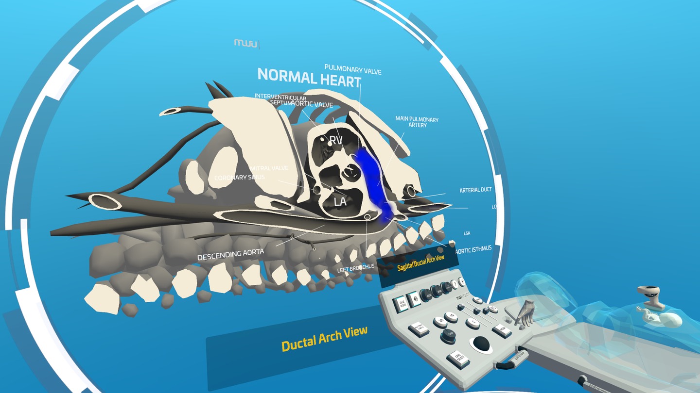 Oculus Quest game "Fetal Heart VR" Fetal Heart VR Oculus Meta Quest all-in-one Education game