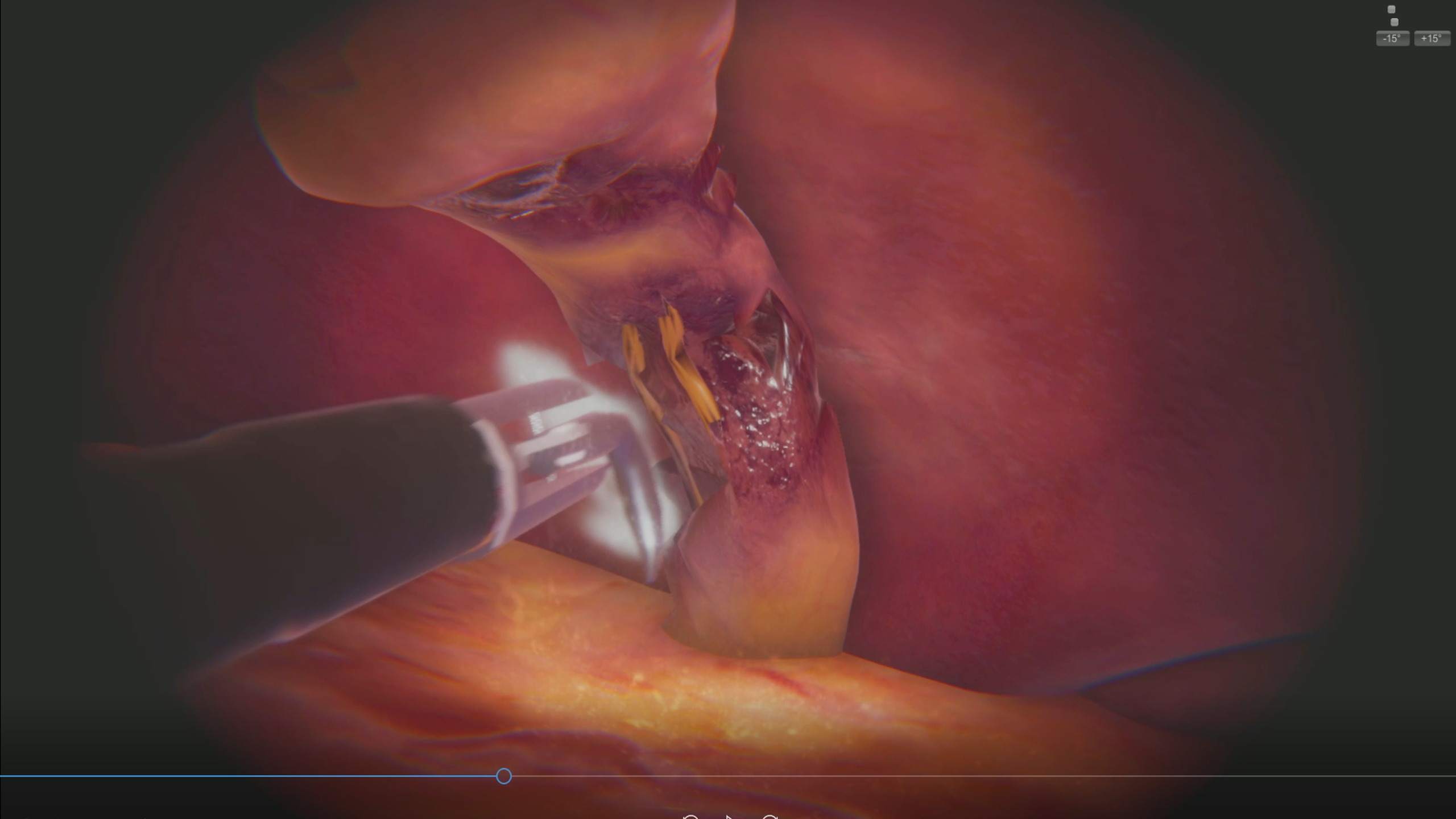 Oculus Quest 游戏《手术VR》SurgicaVR SurgicaVR Oculus Meta Quest Game