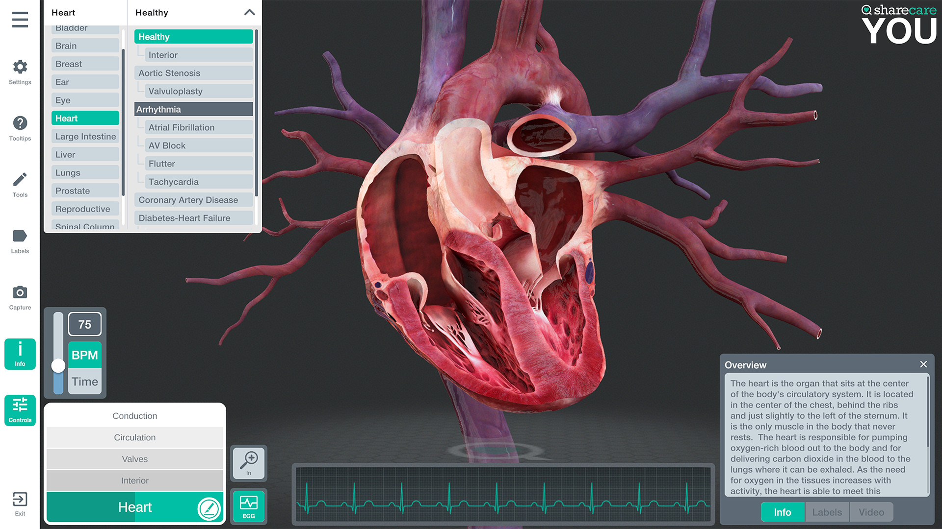 Oculus Quest 游戏《器官解刨学》Sharecare YOU Anatomy VR Sharecare YOU Anatomy Oculus Meta Quest VR Games